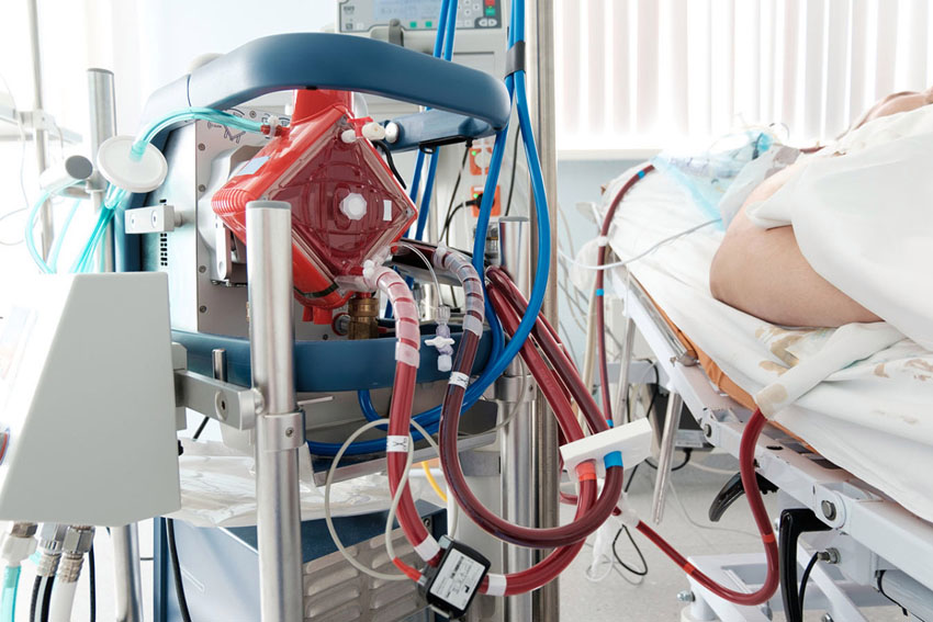 ecmo_GettyImages-998260308官网用.jpg